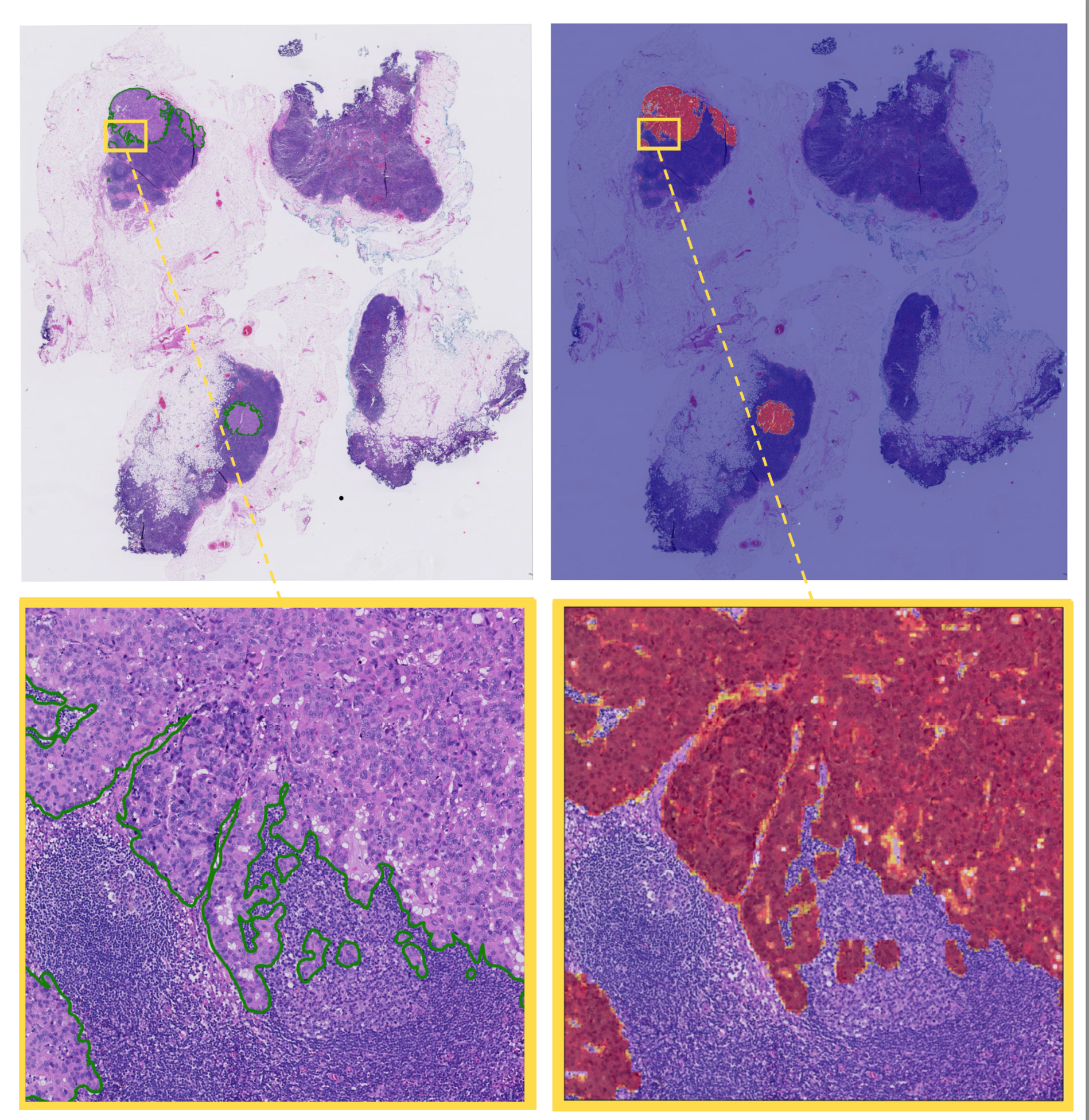 Zoomed Heatmap